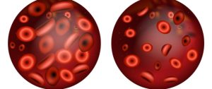 Hematología