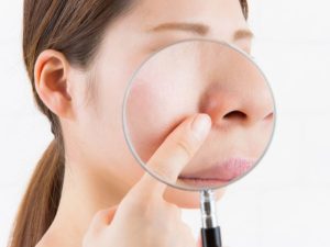 Cuidado facial