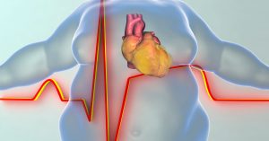 Enfermedades cardiovasculares