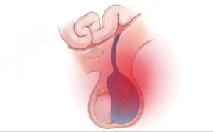 Temas médicos varios