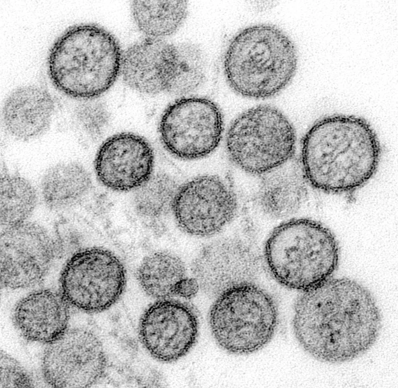 Orthohantavirus: Características y transmisión